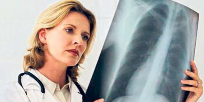 Gölbaşı Toplum Sağlığı Merkezi’nden Tüberküloz uyarısı